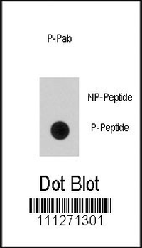 Phospho-EGFR(S768) Antibody
