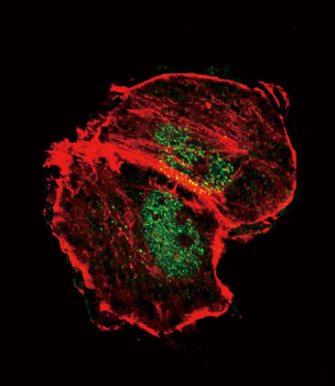 Phospho-TSC2(S664) Antibody