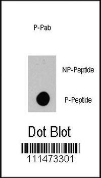 Phospho-BRAF(S445) Antibody
