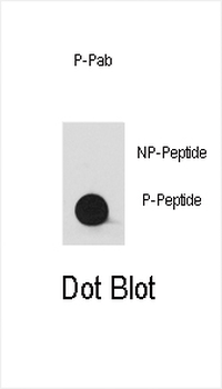 Bi-Phospho-YES1(Y537)/Phospho-SRC(Y530) Antibody