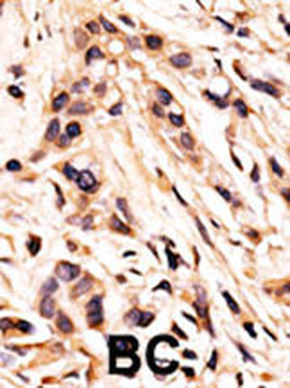 Phospho-RB(S608) Antibody