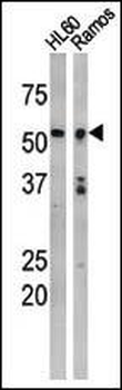 Phospho-P53(S9) Antibody