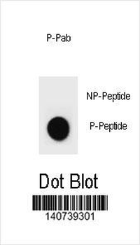 Phospho-ErbB2(Y1248) Antibody