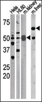 Phospho-CDC25A(S75) Antibody