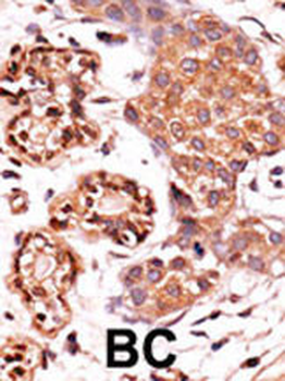 Phospho-ABL1(Y393)/ABL2(439)Antibody
