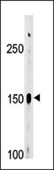 Phospho-ABL1(Y393)/ABL2(439)Antibody