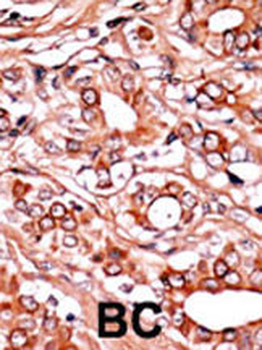 Phospho-ABL1(Y134) Antibody