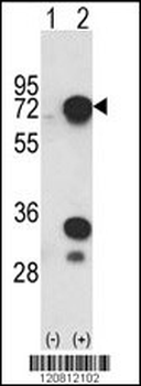 HNRPL Antibody (C-term)