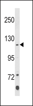 Klotho Antibody (C-term)