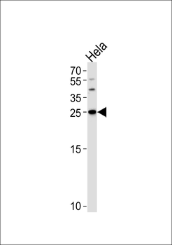 YWHAG Antibody (Center)