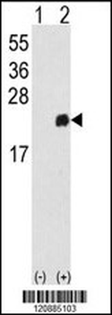 PRDX1 Antibody (Center)