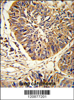 PDIA3 Antibody (C-term)