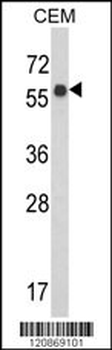 WDR1 Antibody (C-term)
