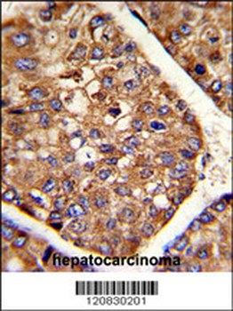 P4HB Antibody (C-term)