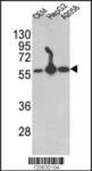 P4HB Antibody (C-term)