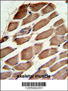 ACTR3 Antibody (C-term)