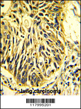 CD201 Antibody (Center)