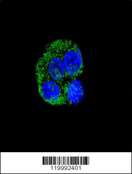 CD36 Antibody (Center)
