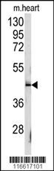 SLAMF1 Antibody (Y307)
