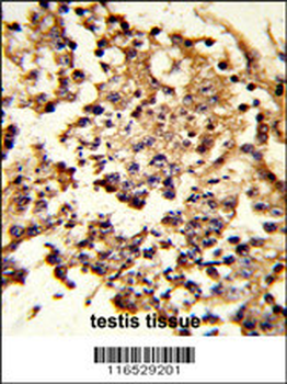 HSPH1 Antibody (Center)