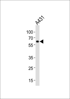 HSPD1 Antibody (Center)
