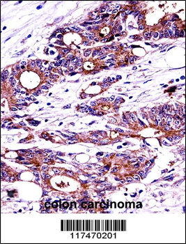 NPM1 Antibody (C-term)