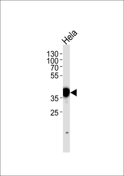 NPM1 Antibody (N-term)