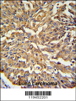 KRT19 Antibody (C-term)