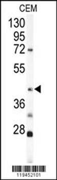 KRT19 Antibody (C-term)