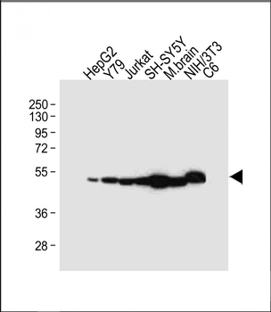 NSE Antibody (Y25)