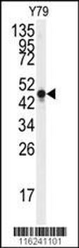 NSE Antibody (Y236)