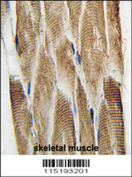 DCX Antibody (S128)