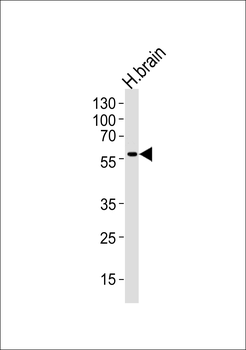 DCX Antibody (S128)