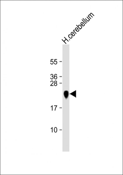 MBP Antibody (Y203)