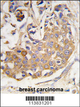 COL9A1 Antibody (Center)