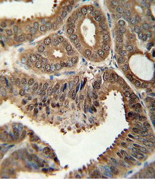 ITGA6 Antibody (isoform 2 S1064)