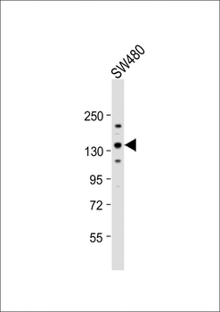 ITGA6 Antibody (isoform 2 S1064)
