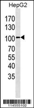 LGR5 (GPR49) Antibody (Center)