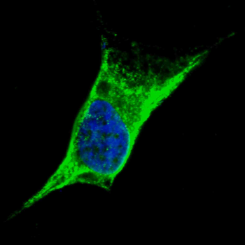 Vimentin Antibody (C-term)