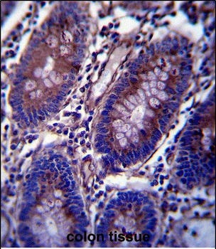 Vimentin Antibody (C-term)