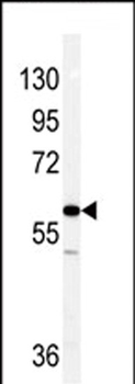 Vimentin Antibody (C-term)