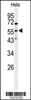 Vimentin Antibody (S82)