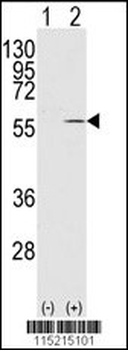 Vimentin Antibody (S82)
