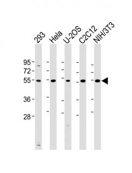 Vimentin Antibody (S82)