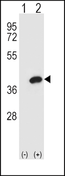 AKR1B1 Antibody (Center)