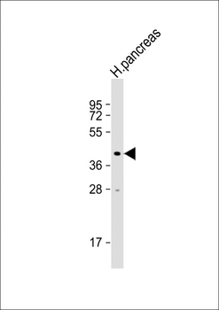 NPTX2 Antibody (Center)