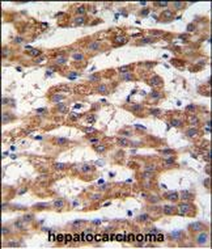 PHB Antibody (Center)
