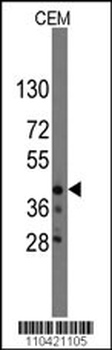 QKI Antibody (N-term)