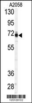 PAPSS1 Antibody (C-term A607)