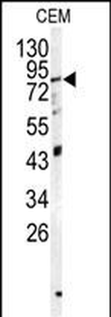 PAPSS1 Antibody (N-term K9)